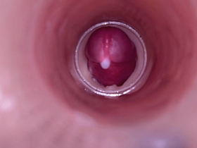 Female Insemination - Internal Camera Captures Deep Male Ejaculation best gay asian sex videos