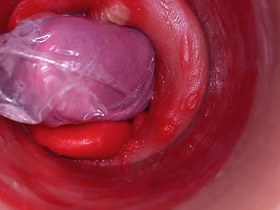 The camera medial the deep pussy records a huge ejaculation with a taken hold of by condom asian forest gay sex videos