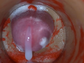 Insemination - Secular Camera Captures Deep Leash Ejaculation asian gay dadies sex videos