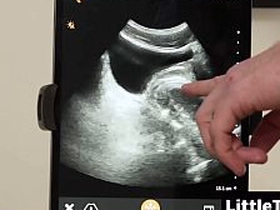 I wanted to watch my dick have a bearing on him with the ultrasound though - Littletwink xxx hot asian gay sex videos